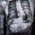 Novis Corpus, de 48 fotógrafos confinados
