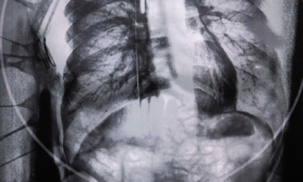 Novis Corpus, de 48 fotógrafos confinados